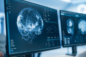 Medical Brain Scans on Multiple Computer Screens. Advanced Neuroimaging Technology Reveals Complex Neural Pathways, Display Showing CT Scan in a Modern Medical Environment Medical Brain Scans on Multiple Computer Screens. Advanced Neuroimaging Technology Reveals Complex Neural Pathways, Display Showing CT Scan in a Modern Medical Environment